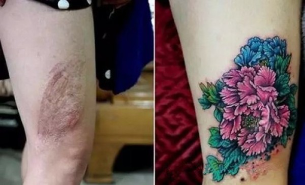 纹身  让你的伤疤开出花来图5