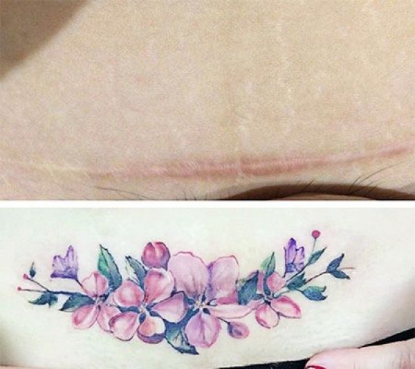 小清新花瓣剖腹产疤痕水彩纹身